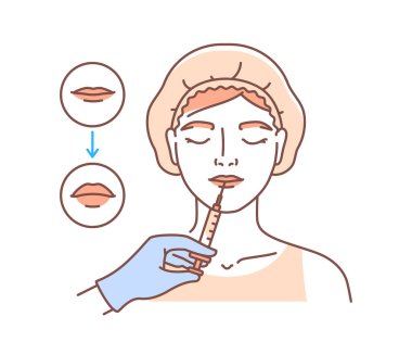 Estetik cerrahi yüz karalaması. Yaşlanma karşıtı prosedürleri olan bir kadın. Güzellik ve cilt bakımı. Dudaklarına iğne batırılmış bir kız. Beyaz arkaplanda izole edilmiş doğrusal düz vektör çizimi