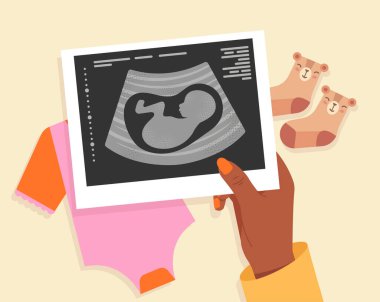 Hand holding ultrasound image with baby onesie and bear-patterned socks on a pastel background. Concept of pregnancy, motherhood, and anticipation. Vector illustration clipart