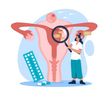 Kadın doktor rahmi büyüteçle inceliyor, beyaz arka planda kist ya da fibroid gösteriyor, yanında haplar ve doğum kontrol hapları var. Jinekoloji kavramı. Vektör illüstrasyonu