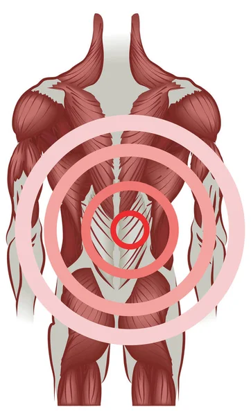 背部肌肉散发出疼痛 不用网状物 — 图库矢量图片
