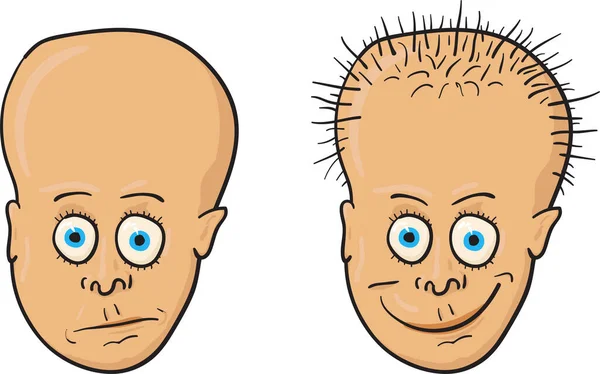 Комический Векторная Иллюстрация Пациента Лысой Головой Растущие Волосы — стоковый вектор