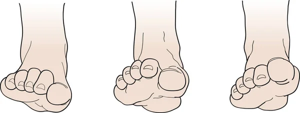 Vector Illustration Human Feet White Background — Stock Vector