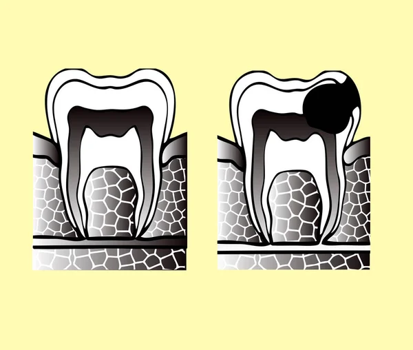 Зуби Сучасні Векторні Ілюстрації — стоковий вектор