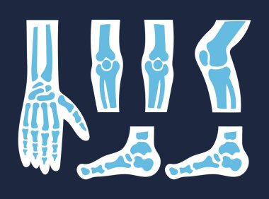 X ray skeleton bones skull foot finger leg tooth isolated set. Vector flat cartoon graphic illustration