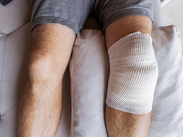 CLOSE UP: Male patient's knee in home care is wrapped in bandages after a meniscus surgery. Detailed shot of a man's legs and his bandaged knee after surgery. Man is recovering after knee surgery.