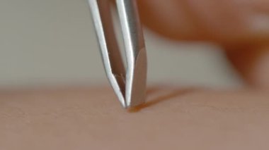 Bir çift titiz metal cımbızla saç yolmanın titiz sürecini yakalayan makro çekim. Yüksek çözünürlüklü gümüş paslanmaz çelik cımbızlar bir saç telini kavrıyor.