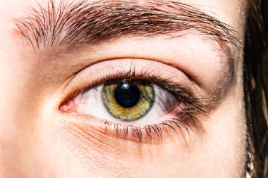 Kızlar yakından bakar, doğal olarak. Göz bebeği büyümüş. Yeşil zambak