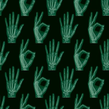 İnsan parmak kemiğinin yeşil X-ray görüntüsü tamam işareti gösteriyor 