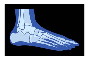 X-Ray Ayak Bacakları İskelet İnsan Vücut Kemikleri - Malleolus, Phalanges Yetişkinler Roentgen yan görüşü. Siyah zemin üzerinde izole edilmiş tıbbi anatominin gerçekçi düz mavi renk konsepti Vektör çizimi