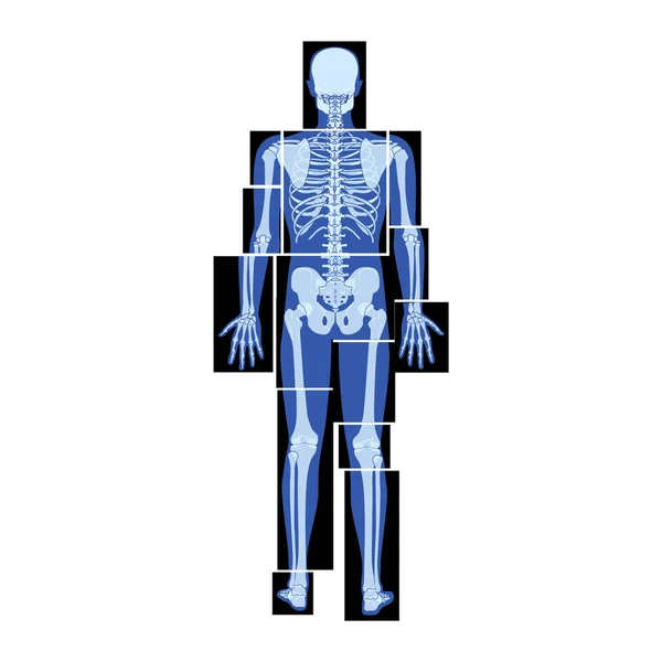 一组X射线骷髅人体部位 骨骼等成年人的后视镜 医学解剖学的三维逼真平面蓝色概念矢量图解 — 图库矢量图片