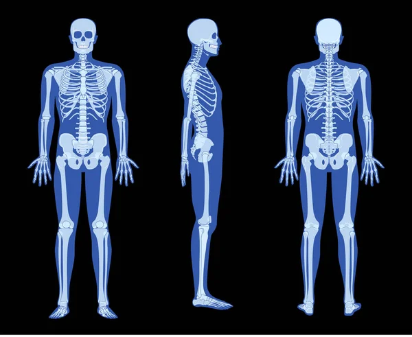 Комплект Рентгеновского Скелета Человеческое Тело Руки Ноги Груди Головы Позвонки — стоковый вектор