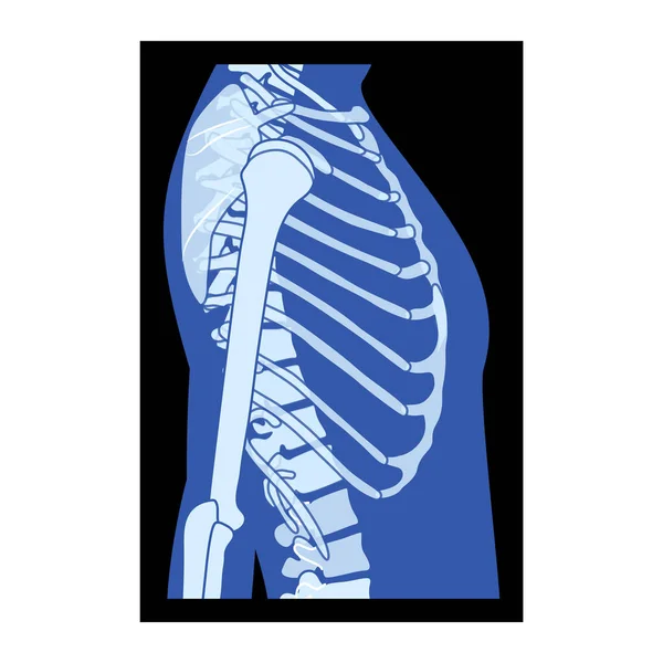 X線リブケージと手スケルトン人体骨大人の人々 Roentgen側のビュー 3Dリアルなフラットブルーカラーコンセプト黒の背景に隔離された医学解剖学のベクトルイラスト — ストックベクタ