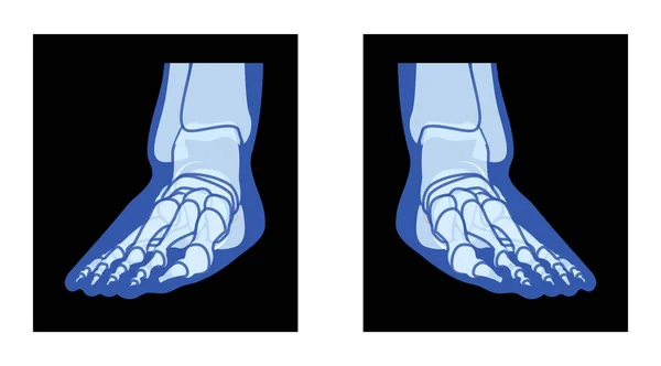 X射线脚腿骨骷髅人体骨骼 软骨动物 长腿长腿的成年人伦琴前视 黑色背景下医学解剖分离的真实感平面蓝色概念矢量图解 — 图库矢量图片