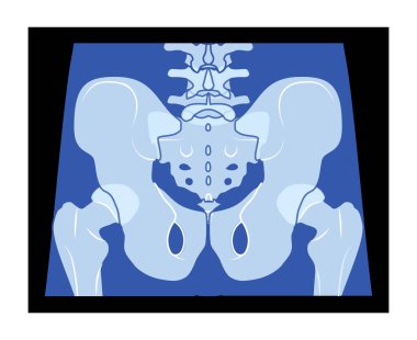 X-Ray leğen kemiği iskelet kalça insan vücudu yetişkin insanların röntgenleri. Siyah zemin üzerinde izole edilmiş tıbbi anatominin 3D gerçekçi düz mavi renk konsepti Vektör illüstrasyonu