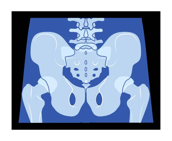 Pelvis Rayos Esqueleto Cadera Cuerpo Humano Huesos Personas Adultas Roentgen — Archivo Imágenes Vectoriales