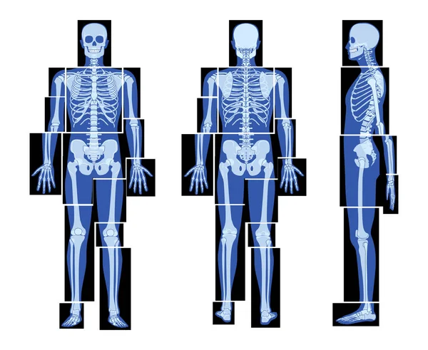 Set Van Ray Skeleton Menselijke Lichaamsdelen Handen Benen Borst Hoofd — Stockvector