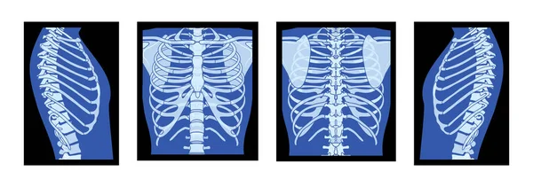 X線リブケージのセットスケルトン人間の体 骨大人の人々の後ろ側のビューRoentgenフロント 3Dリアルなフラットブルーカラーのコンセプト医療解剖学のベクトルイラスト孤立 — ストックベクタ