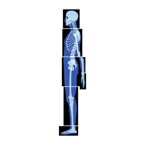 Set Röntgenskelett Menschliche Körperteile Hände Beine Brust Kopf Wirbel Becken — Stockvektor