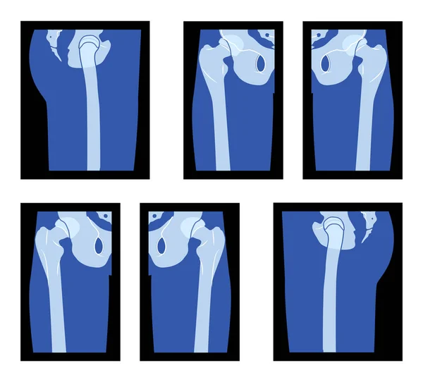 Set Ray Hip Leg Head Femur Skeleton Human Body Bones — Stock Vector