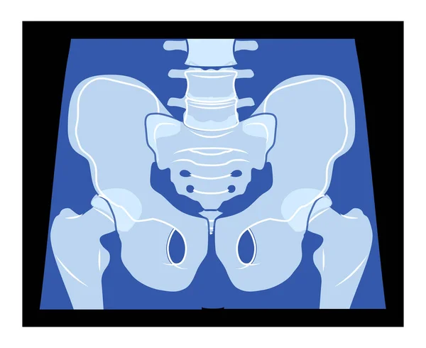 X光骨盆骷髅髋骨人身体骨骼成年人伦琴前视 医学解剖学在黑色背景下的三维逼真平面蓝色概念矢量图解 — 图库矢量图片