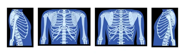 X線リブケージと手のセットスケルトン人体骨大人の人々は正面裏側のビューをRoentgen 3Dリアルなフラットブルー医療解剖図黒の背景に隔離された医療解剖図 — ストックベクタ
