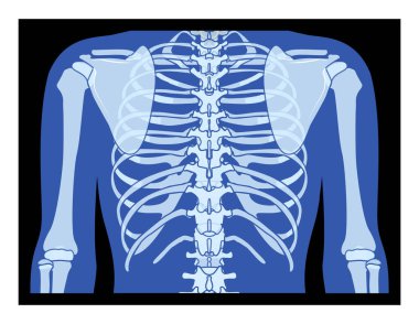X-Ray göğüs kafesi ve iskelet insan vücudu yetişkin insanların röntgenleri. Siyah zemin üzerinde izole edilmiş tıbbi anatominin 3D gerçekçi düz mavi renk konsepti Vektör illüstrasyonu