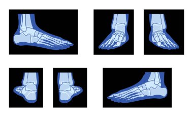 X-Ray Ayak Bacakları İskelet İnsan Vücut Kemikleri Yetişkin insanların ön arka görüşü. Siyah zemin üzerinde izole edilmiş tıbbi anatominin 3D gerçekçi düz mavi renk konsepti Vektör illüstrasyonu