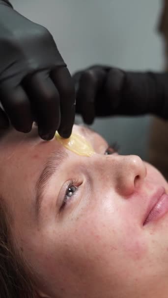 Der Haarentfernungsmeister Trägt Wachs Auf Das Gesicht Des Kunden Auf — Stockvideo