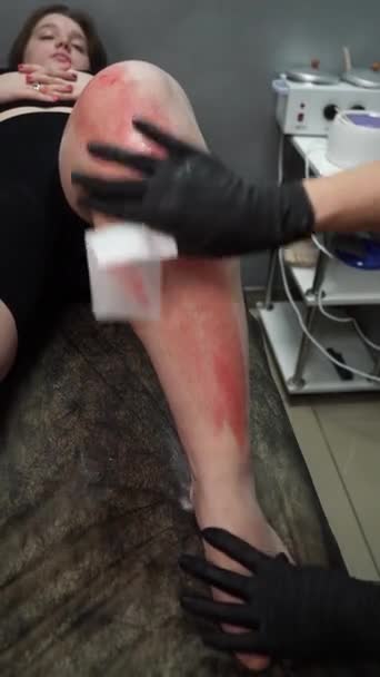 Saç Temizleme Ustası Müşterinin Bacağına Ağda Uyguluyor Balmumuyla Deplasyon — Stok video