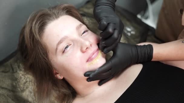 脱毛大师在病人的脸上涂蜡 用蜡去除妇女的胡子 后续行动 — 图库视频影像