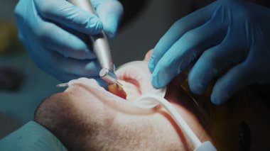 Diş tedavisi sırasında sandalyeye uzanmış tanınmayan bir erkek hastayı yakından çek. Mavi steril eldivenli doktor özel aletler ve delme dişi kullanıyor. Kapalı