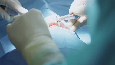Steril cerrahi eldivenlerle dişçi ve sağlık çalışanlarının hastaların dişlerini parlatması. Tıp, sağlık hizmetleri konsepti. İçeride. Klinik