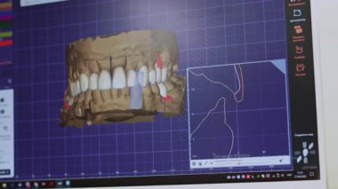 Bu proje gelişmiş görüntüleme yazılımı kullanan karmaşık diş yapılarının ayrıntılı bir üç boyutlu temsilini gösterir