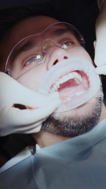 Dişçi bir adamın dişlerini temizler. Modern klinikte hijyenik ve sağlıklı. Sağlık hizmetleri. Koruyucu gözlük