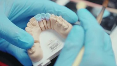 Kapalı eller dişçi takma diş temizliği doktoru, teknisyen sağlık kliniği hijyen cerrahi rehabilitasyonu ağır çekimde rehabilitasyon