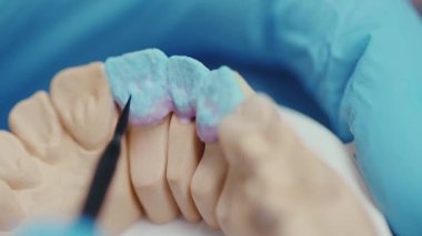 Yavaş çekimde çalışan dişçi takma diş temizliği doktoru, teknisyen sağlık kliniği hijyen cerrahi rehabilitasyonu...