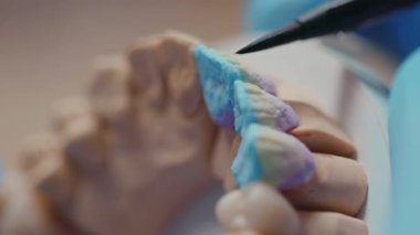 Kapalı eller dişçi takma diş temizliği doktoru, teknisyen sağlık kliniği hijyen cerrahi rehabilitasyonu ağır çekimde rehabilitasyon