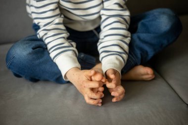 Deri döküntüsü, gül, el ve ağız hastalığı, çocuk döküntüsü.