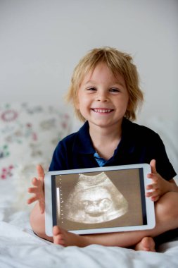 Küçük tatlı çocuk, ultrasonda doğmamış küçük kız kardeşinin fotoğrafını tutuyor.