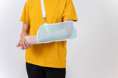 Kırık kollu, yara bandına sarılı bir kadının, bir kazadan sonra kolunu desteklemek için askı taktığı, beyaz bir arkaplanda durduğu yakın plan bir fotoğraf. Hayat sigortası ve sağlık hizmeti