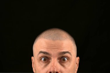 Gözü açık kel bir adamın yakın plan portresi ve siyah bir arkaplan karşısında şaşırmış bir ifade. Şok olmuş yüz ifadesi şaşkınlık, şaşkınlık ya da güvensizlik taşır..