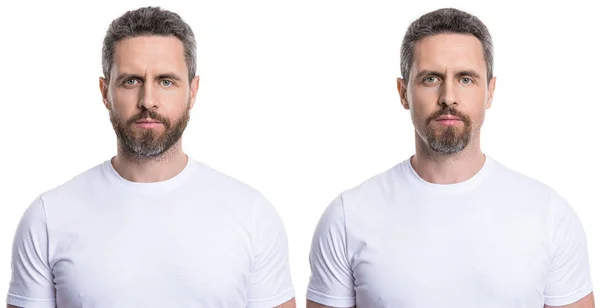 Vergleich Zweier Bärtiger Männer Vor Und Nach Dem Studiobesuch Männer — Stockfoto