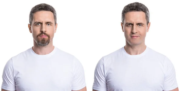 Erwachsener Mann Gesicht Rasiert Vergleich Vor Und Nach Dem Hintergrund — Stockfoto