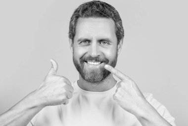 Stüdyoda dişleri gösteren gülümseyen adam başparmağını kaldır. Adamın diş tebessümünü gösteren fotoğrafı. Dişleri gösteren adam sarıda izole bir şekilde gülümsedi. Adam arka planda gülümseyen dişlere işaret ediyor..