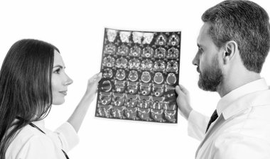 Doktor X-ray 'i beyazda izole etti. Doktor nörolog, röntgen taraması. Klinikteki doktor röntgen film sağlık hizmetlerine bakıyor, Roentgen. Tıbbi önlüklü doktor röntgen beynini radyografik olarak tutuyor..