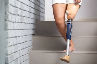 Yakın plan bacak genç Asyalı engelli kadın merdivenlerde yürüyen, yakın plan bacaklı kadın, merdivenlerde protez giyen, yaşam tarzı konsepti.