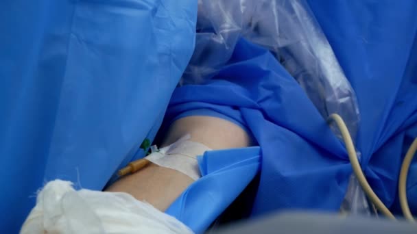 病院の手術室における手術中の全身麻酔下患者の腕の静脈カテーテルの閉鎖 — ストック動画