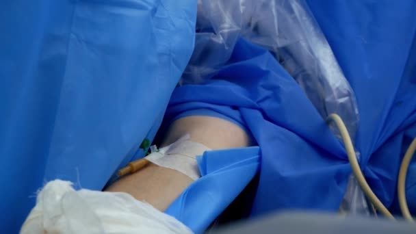 Close Venous Catheter Arm Patient General Anesthesia Surgical Operation Operating — Vídeo de Stock