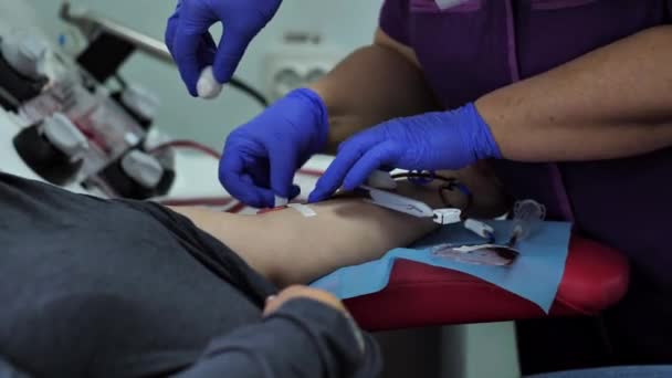 Infermiera Rimuove Catetere Una Vena Arteria Sul Braccio Una Donatrice — Video Stock