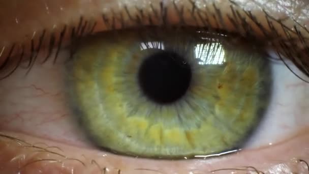 Közeli Makró Felvétel Zöld Íriszszel Szűkült Pupillával Kitágult Vénák Vagy — Stock videók